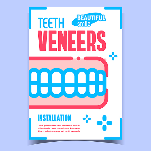 Teeth Veneers Creative Advertising Banner Vector. Installation Veneers For Beautiful Smile. Dental Treatment, Medical Healthy Mouth Therapy Concept Template Stylish Colorful Illustration