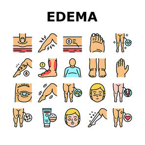 Edema Disease Symptom Collection Icons Set Vector. Venous And Fatty, Lymphatic And Hypoproteinemic, Allergic And Heart Edema Health Problem Concept Linear Pictograms. Contour Color Illustrations