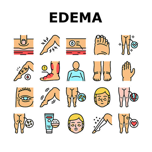Edema Disease Symptom Collection Icons Set Vector. Venous And Fatty, Lymphatic And Hypoproteinemic, Allergic And Heart Edema Health Problem Concept Linear Pictograms. Contour Color Illustrations