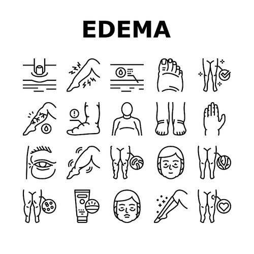 Edema Disease Symptom Collection Icons Set Vector. Venous And Fatty, Lymphatic And Hypoproteinemic, Allergic And Heart Edema Health Problem Black Contour Illustrations