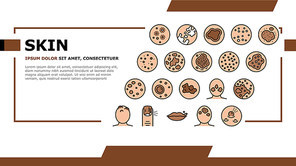 Skin Disease Symptom Landing Web Page Header Banner Template Vector. Skin Cancer And Acne, Vitiligo And Bruise, Eczema And Chronic Blistering, Herpes And Mycosis Illustration