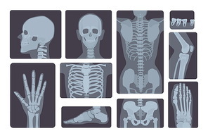 Realistic x-ray shots collection. Human body hand, leg, skull, foot, chest, teeth spine and other