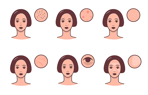 Set of female faces with various skin conditions and problem. Skincare and dermatology concept. Vector colorful illustration