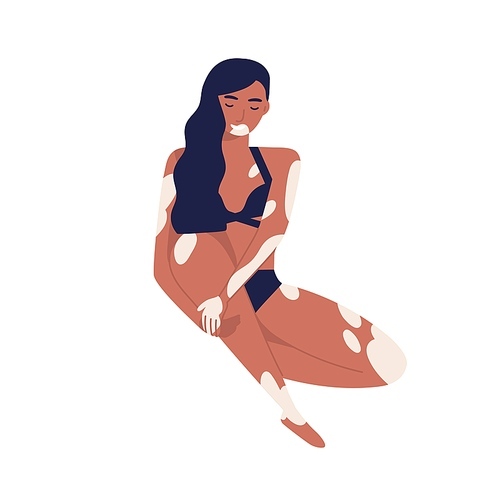Young self acceptance woman with vitiligo relaxing in bikini. Body positive, brunette girl with skin depigmentation or pigmentation. Flat vector cartoon illustration isolated on white .