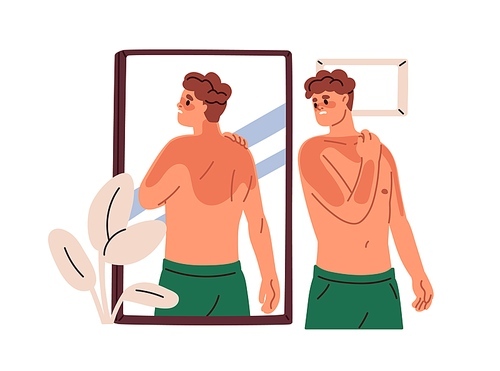 Man with reddish body after sun UV, looking at skin sunburns in mirror. Suntan burns problem on body. Sad person with burnt spots. Flat graphic vector illustration isolated on white background.