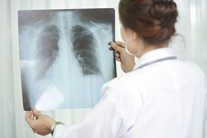 Rear view of female lung specialist checking chest x-ray of patient