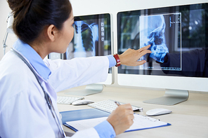 Young female doctor sitting at the table and pointing at skull x-ray image of her patient on computer, she examining the problem of the disease