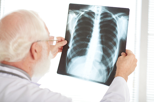 Over the shoulder view of senior doctor examining chest x-ray image