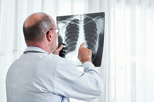 Radiologist examining lungs x-ray of patient and searching for signs of cancer