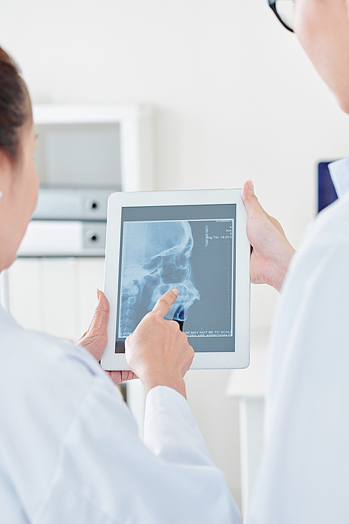 Surgeon pointing at jaw x-ray of patient on tablet computer when talking to coworker