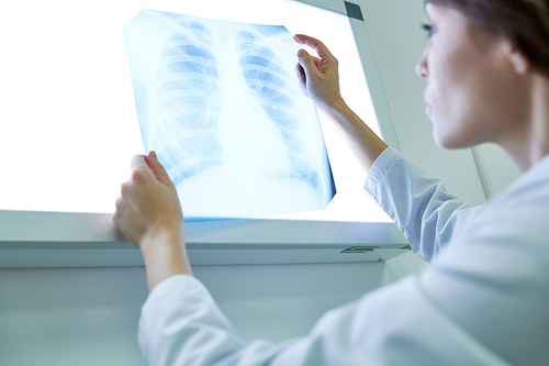 Crop female medic examining X-ray image of chest holding it against lightbox.