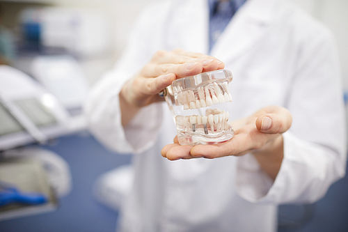 Close up of unrecognizable  dentist holding teeth model for prosthetists, copy space