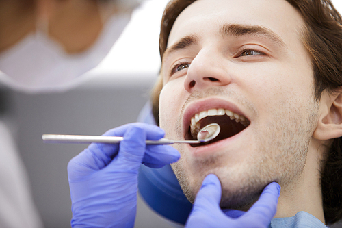 Closeup of smiling man with mouth open looking at dentist during checkup, copy space