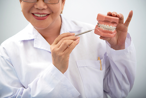 Female dentist holding plastic model of jaw with braces on teeth