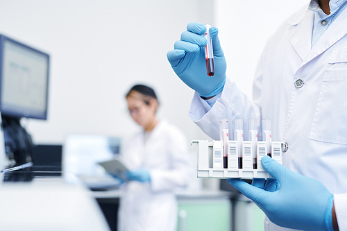 Close-up of unrecognizable scientist in sterile gloves holding test tube rack and preparing medical sample for virus research in laboratory