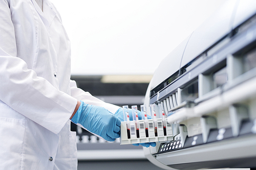 Close-up of unrecognizable laboratory technician in white coat and sterile gloves putting blood samples into tube roller mixer