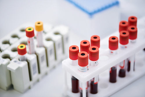 Close-up of blood test tube rack with prepared samples placed on table in laboratory