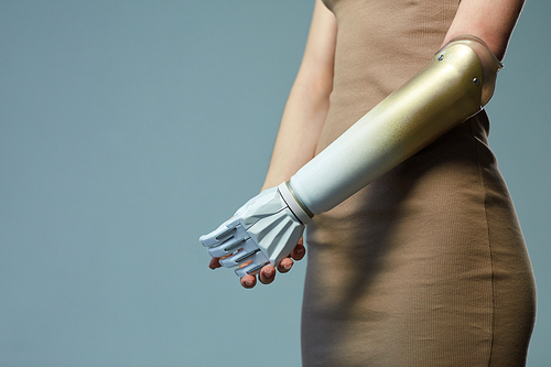 Close-up of young beautiful girl in dress having prosthetic arm standing against blue background