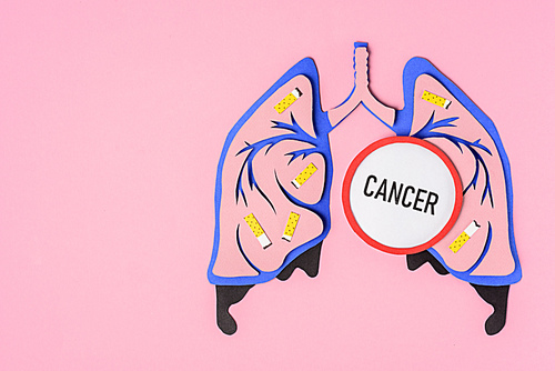 top view of human lungs with cigarettes and lettering cancer on pink