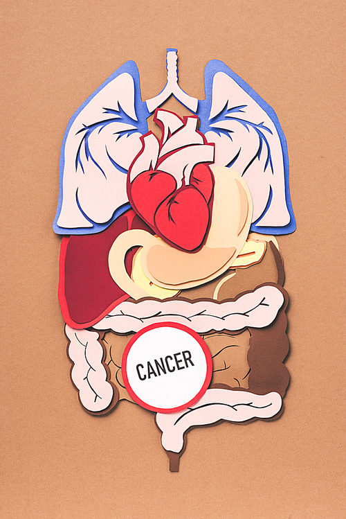 flat lay with human internal organs and lettering cancer on brown