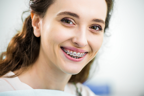 close up of happy woman with braces on teeth smiling in dental clinic
