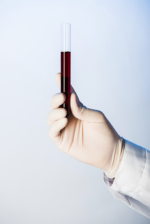 Partial view of doctor holding test tube with blood