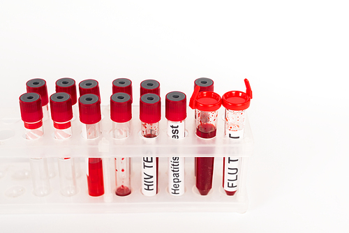 test tubes with blood samples and lettering isolated on white
