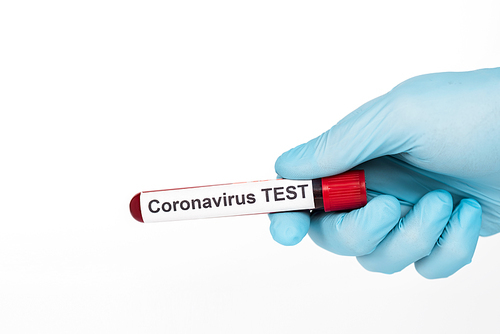 cropped view of scientist holding sample with coronavirus test lettering isolated on white