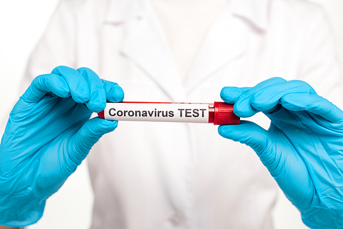 cropped view of scientist in latex gloves holding sample with blood and coronavirus test lettering isolated on white
