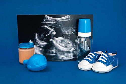ultrasound scan, baby bottle, toy, baby shoes, jar with baby food ob blue background