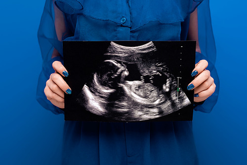 cropped view of woman holding ultrasound scan isolated on blue