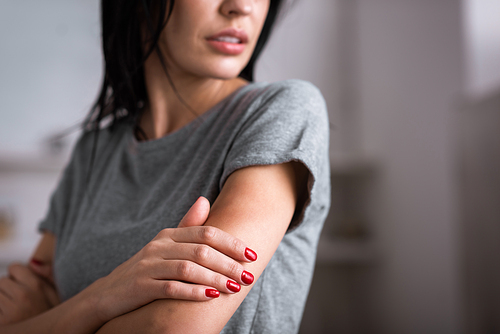 cropped view of sad woman touching bruise on hand, domestic violence concept