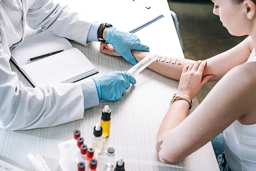 overhead view of allergist holding ruler near marked hand of woman