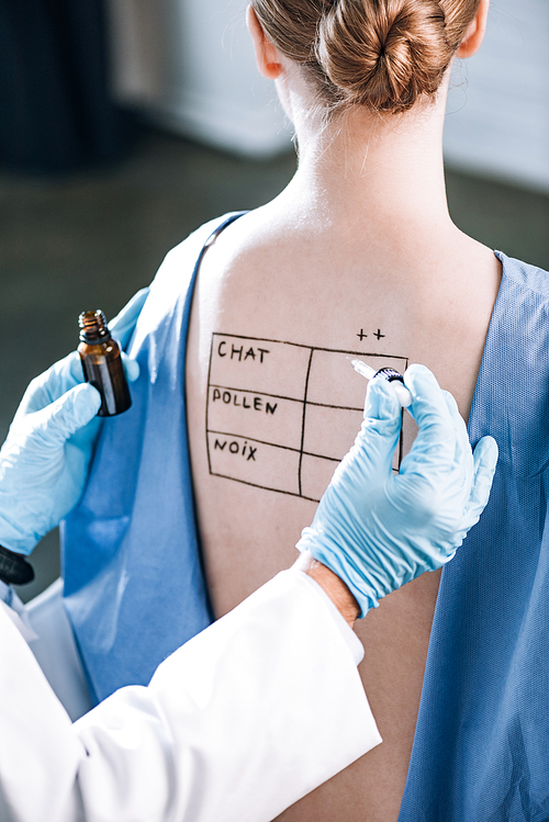 cropped view of allergist holding pipette near woman with letters on marked back