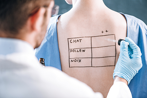 selective focus of allergist holding pipette near woman with letters on marked body