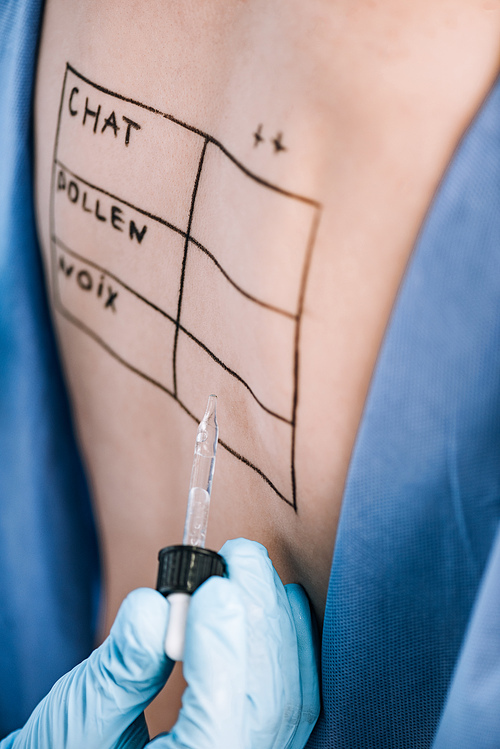 selective focus of doctor holding pipette near woman with letters on marked back