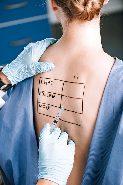 cropped view of allergist holding pipette near patient with letters on marked body