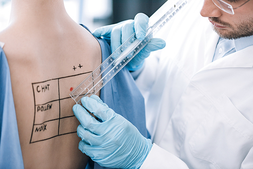 cropped view of bearded allergist holding ruler near patient with marked back