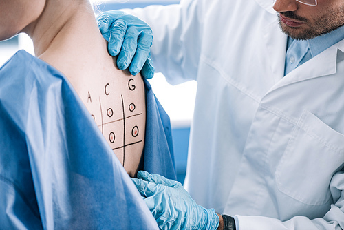 cropped view of allergist touching marked back with numbers and letters