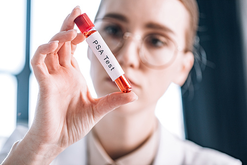 selective focus of attractive immunologist in glasses looking at test tube with psa test letters