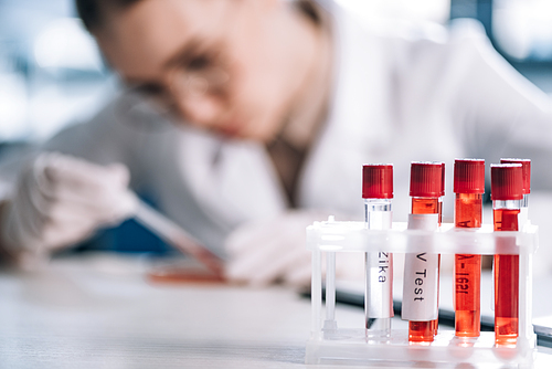 selective focus of glass test tube with letters near immunologist