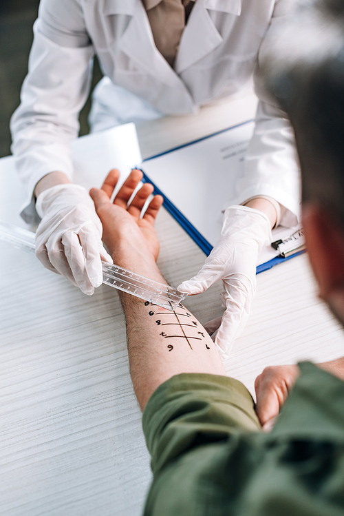 overhead of allergist in latex gloves holding ruler near marked hand on man in clinic