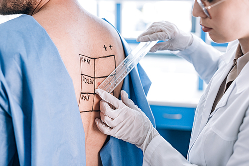 cropped view of allergist holding ruler near man with marked back