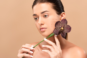naked woman with problem skin holding orchid near face isolated on beige
