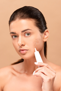 naked girl holding treatment cream near face with problem skin and looking at camera isolated on beige