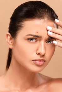 naked woman with pimple on face touching forehead isolated on beige
