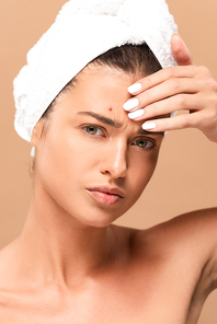 young naked woman with pimple on face touching forehead isolated on beige