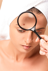 cropped view of man holding magnifier near woman with pimple on face