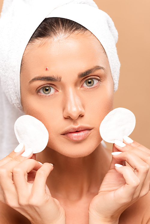 young woman with pimple on face holding cotton pads isolated on beige