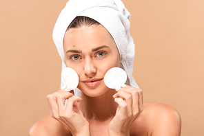 happy naked woman with pimple on face holding cotton pads isolated on beige